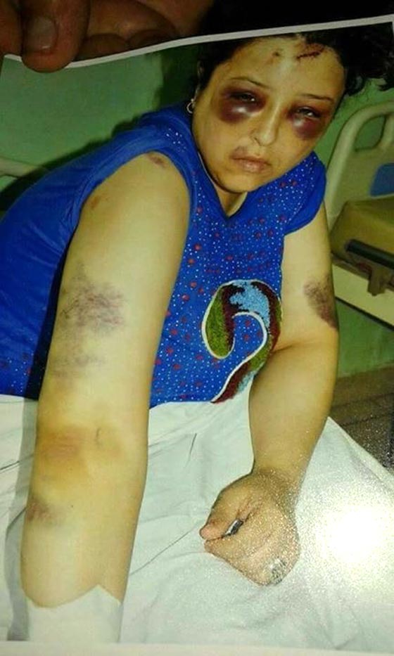 صور مؤلمة.. هذا ما فعلوه بسيدة مصرية بسبب علبة سجائر صورة رقم 1