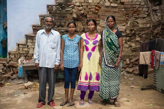 أم وابنتها تعيشان مع رجل شوههما بماء النار.. فيديو وصور صورة رقم 8