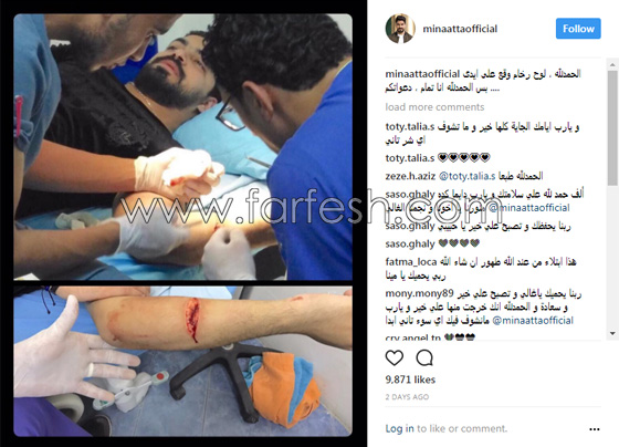 صور مينا عطا نجم ستار اكاديمي في المستشفى بسبب جرح عميق في ذراعه صورة رقم 1