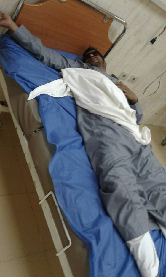 اقتلعوا عينيه بوحشية لاجباره على تطليق زوجته لتزويجها من آخر صورة رقم 3