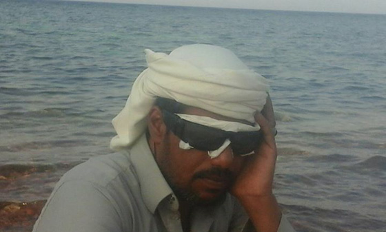 اقتلعوا عينيه بوحشية لاجباره على تطليق زوجته لتزويجها من آخر صورة رقم 2