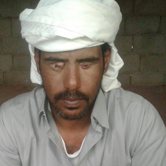 اقتلعوا عينيه بوحشية لاجباره على تطليق زوجته لتزويجها من آخر صورة رقم 1