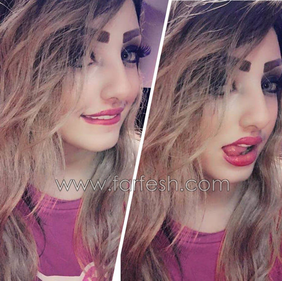 مفاجآت صادمة بقضية وفاة الراقصة غزل اثناء عملية اجهاض! صورة رقم 8
