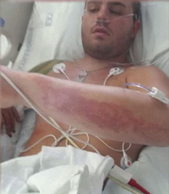 صاعقة برق تضرب طائرة وتصيب عاملا على ارض المطار.. فيديو صورة رقم 5