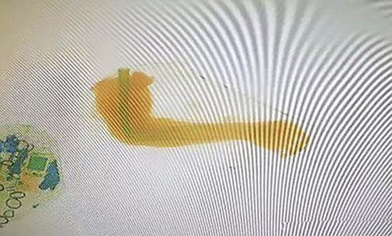 العثور على ذراع بشرية بحقيبة مسافر صورة رقم 3