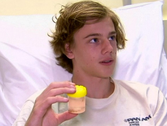 بالفيديو والصور.. ناهشات للحوم هاجمت هذا المراهق وكادت أن تنهي حياته  صورة رقم 6