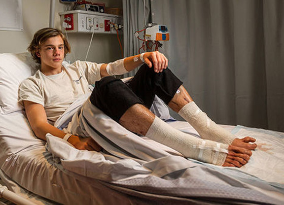 بالفيديو والصور.. ناهشات للحوم هاجمت هذا المراهق وكادت أن تنهي حياته  صورة رقم 7