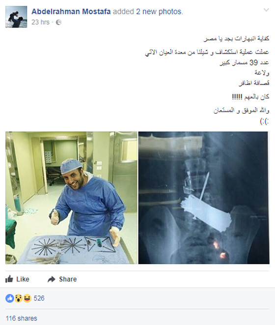  طبيب مصري يستخرج 39 مسمار ومجموعة أشياء معدنية من معدة مريض صورة رقم 1