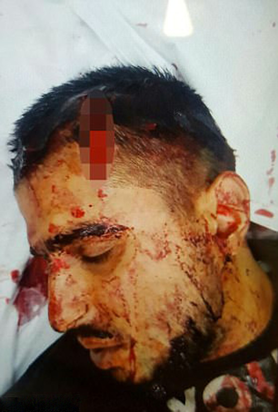 ملثم يهاجم عاملين عربيين ويغرقهما بالدماء في بريطانيا.. فيديو صورة رقم 1