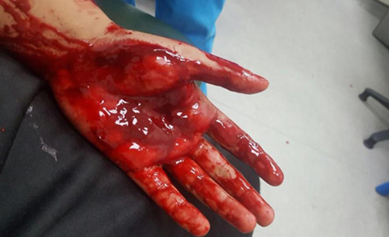 ملثم يهاجم عاملين عربيين ويغرقهما بالدماء في بريطانيا.. فيديو صورة رقم 3