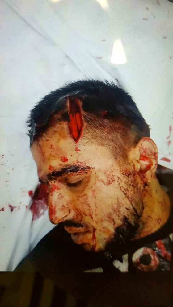 ملثم يهاجم عاملين عربيين ويغرقهما بالدماء في بريطانيا.. فيديو صورة رقم 11