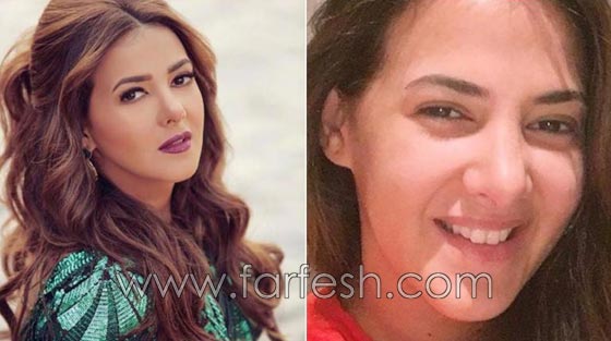 صور فنانات غيّرن ملامح وجوههن بدون عملبات تجميل.. ما هو السر؟ صورة رقم 6