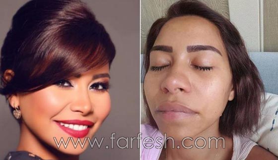 صور فنانات غيّرن ملامح وجوههن بدون عملبات تجميل.. ما هو السر؟ صورة رقم 3