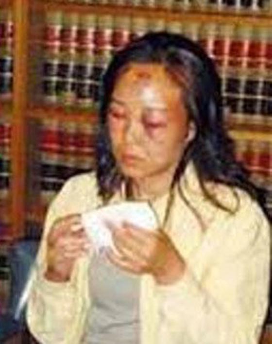 حرس الحدود الامريكي اعتدى عليها بوحشية والمحكمة تعوضها بمبلغ ضخم صورة رقم 2