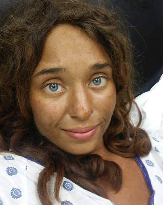 بالفيديو والصور.. العثور على فتاة امريكية فقدت في الغابة  منذ 3 اسابيع صورة رقم 1