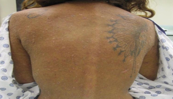 بالفيديو والصور.. العثور على فتاة امريكية فقدت في الغابة  منذ 3 اسابيع صورة رقم 8