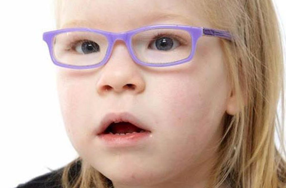 حالة نادرة.. طفلة لا تشبع أبداً مهما أكلت صورة رقم 1