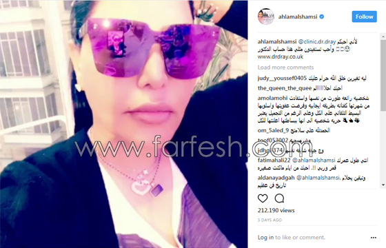 فيديو الفنانة أحلام تعترف باجراء عملية تجميل جديدة من اجل 