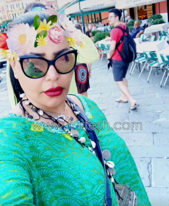 فيديو الفنانة أحلام تعترف باجراء عملية تجميل جديدة من اجل 