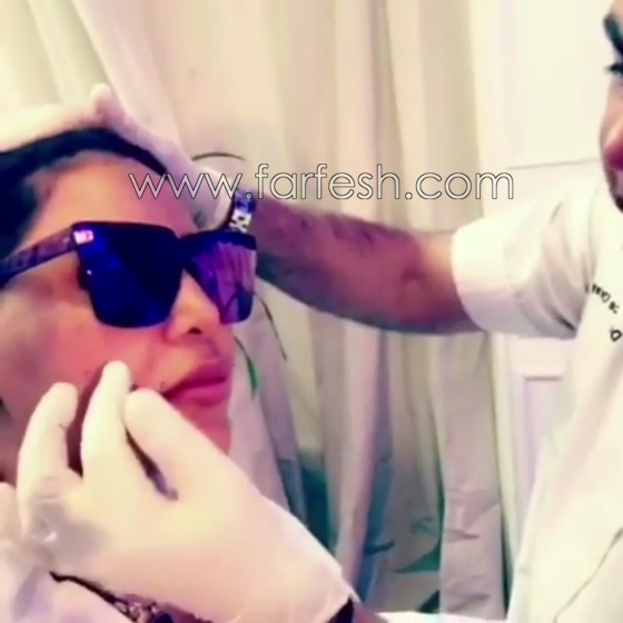 فيديو الفنانة أحلام تعترف باجراء عملية تجميل جديدة من اجل 