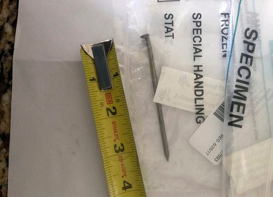 بالفيديو والصور.. مسمار يخترق قلب رجل أمريكي أطلقه على نفسه بالخطأ صورة رقم 3