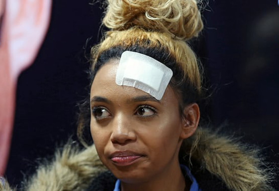 اتهام سيدة زيمبابوي الأولى بالإعتداء على عارضة أزياء بالضرب! صورة رقم 1