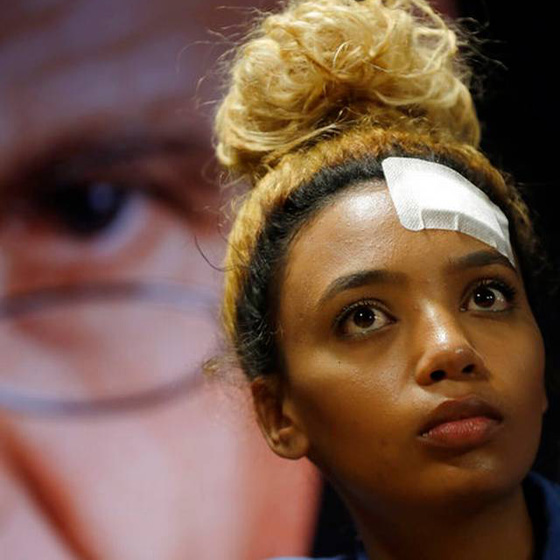 اتهام سيدة زيمبابوي الأولى بالإعتداء على عارضة أزياء بالضرب! صورة رقم 5