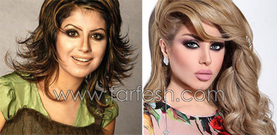 صور حليمة بولند قبل عمليات التجميل وفي طفولتها: 15 صورة ستصدمك! صورة رقم 1