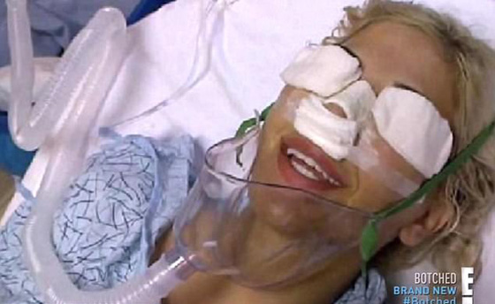 الهوس! أجرت 13 عملية جراحية في أقل من سنة لتشبه إيفانكا ترامب صورة رقم 2