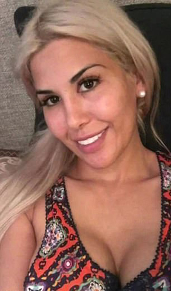 الهوس! أجرت 13 عملية جراحية في أقل من سنة لتشبه إيفانكا ترامب صورة رقم 6