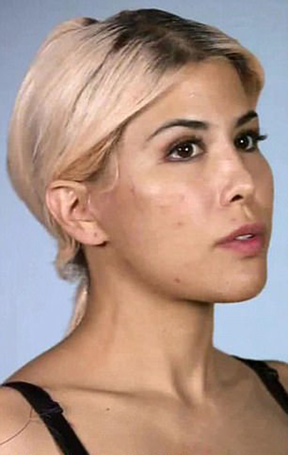 الهوس! أجرت 13 عملية جراحية في أقل من سنة لتشبه إيفانكا ترامب صورة رقم 16