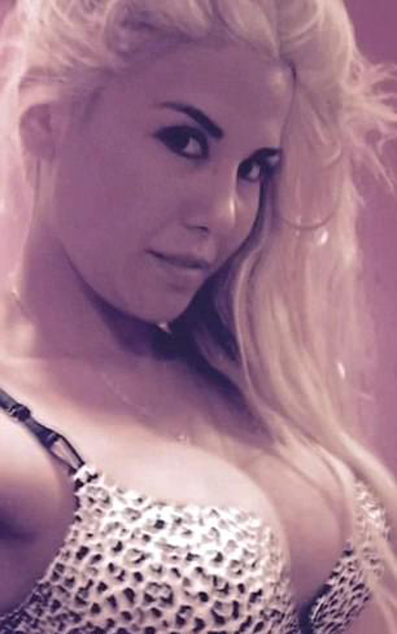 الهوس! أجرت 13 عملية جراحية في أقل من سنة لتشبه إيفانكا ترامب صورة رقم 19