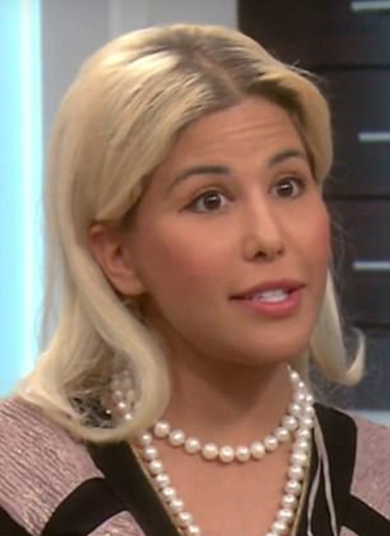 الهوس! أجرت 13 عملية جراحية في أقل من سنة لتشبه إيفانكا ترامب صورة رقم 20