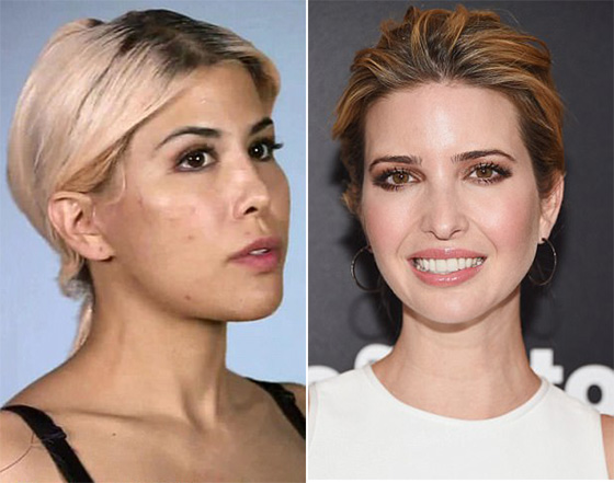 الهوس! أجرت 13 عملية جراحية في أقل من سنة لتشبه إيفانكا ترامب صورة رقم 4