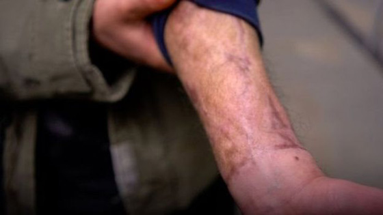 فتاة مصرية تحولت في اسكتلندا الى (آدم)، ومصري تحوّل الى (كارلا) في المانيا! صورة رقم 4