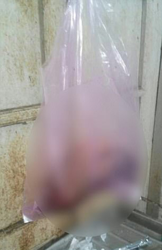 سفّاح هندي يقطع يد فتاة قاصر بالسيف لانها رفضت مرافقته.. فيديو صورة رقم 4