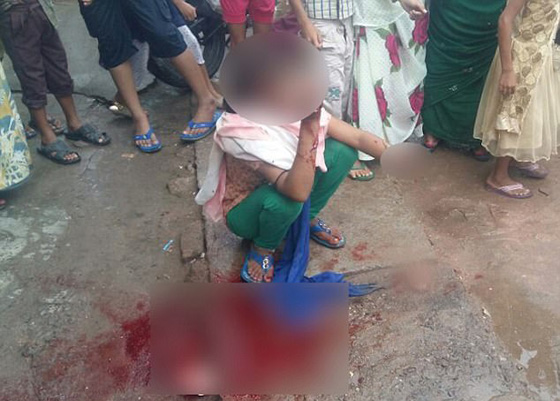 سفّاح هندي يقطع يد فتاة قاصر بالسيف لانها رفضت مرافقته.. فيديو صورة رقم 1