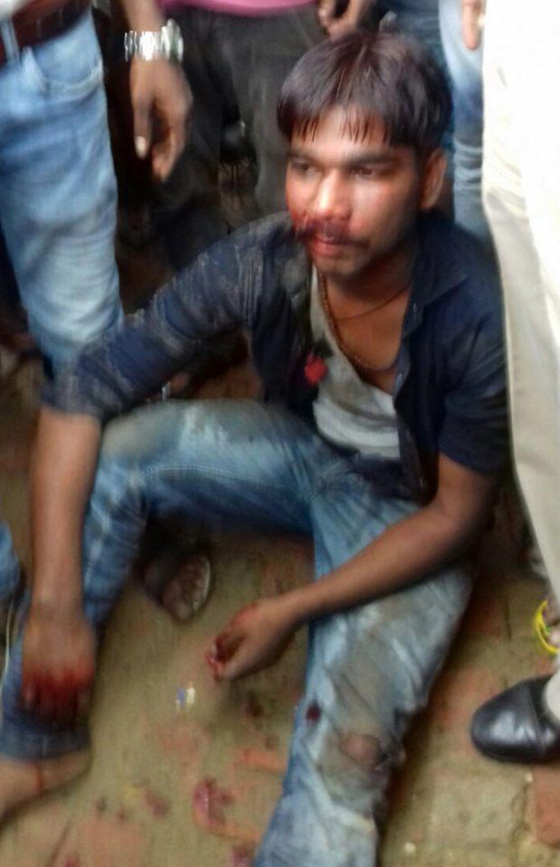 سفّاح هندي يقطع يد فتاة قاصر بالسيف لانها رفضت مرافقته.. فيديو صورة رقم 2