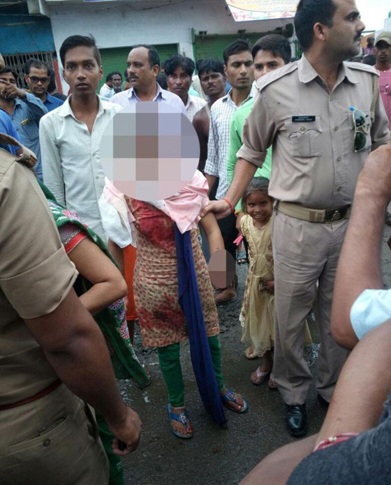 سفّاح هندي يقطع يد فتاة قاصر بالسيف لانها رفضت مرافقته.. فيديو صورة رقم 3