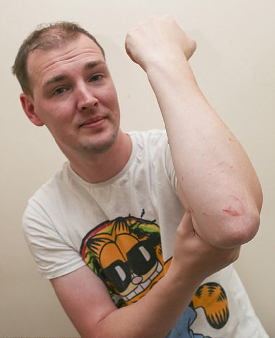 بريطانيا: 8 قتلى وعدة اصابات في أسوأ حادث سير منذ سنوات صورة رقم 23