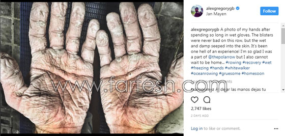 هكذا تبدو أيدي البطل الأولمبي في التجديف الذي جاب المحيط المتجمد الشمالي.. صورة رقم 1