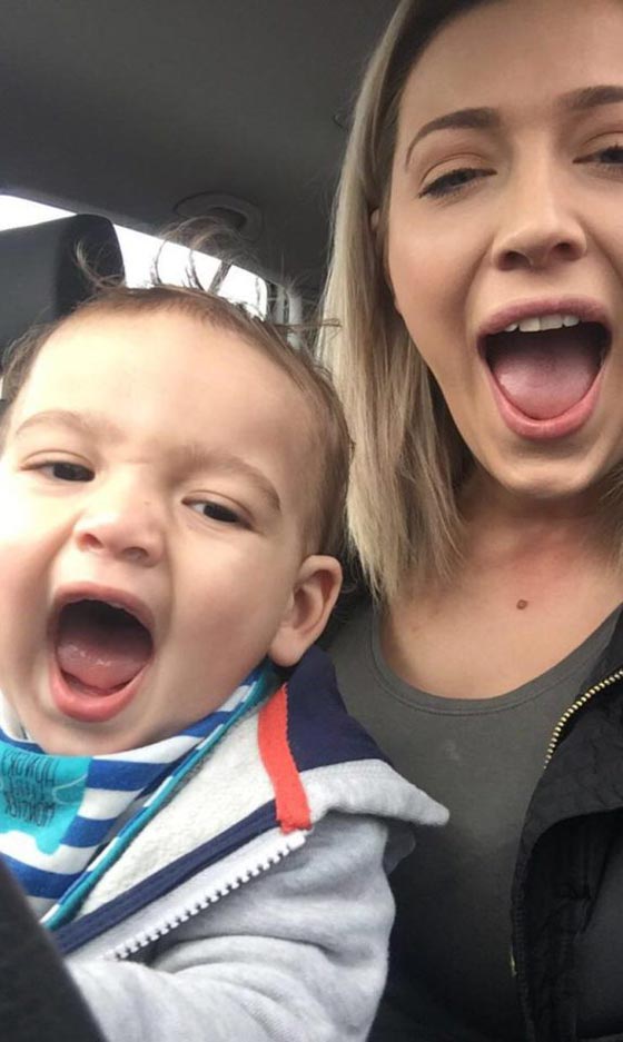 حروق مروعة على وجه وجسم طفل صغير بسبب اهمال عاملة الحضانة!! صورة رقم 7