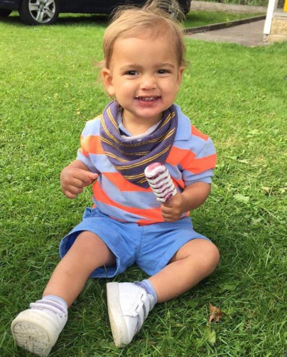 حروق مروعة على وجه وجسم طفل صغير بسبب اهمال عاملة الحضانة!! صورة رقم 8