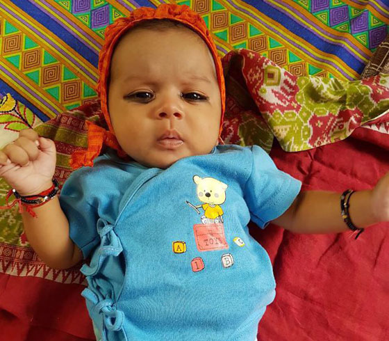 اطباء يقتلعون 7 اسنان من فم طفل عمره شهر لمساعدته على الرضاعة صورة رقم 6