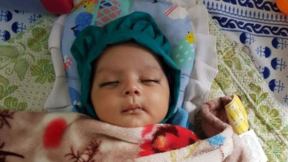 اطباء يقتلعون 7 اسنان من فم طفل عمره شهر لمساعدته على الرضاعة صورة رقم 8