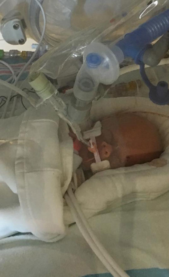 قصة مؤثرة للغاية.. امريكية اختارت ان تموت لكي يعيش جنينها صورة رقم 8