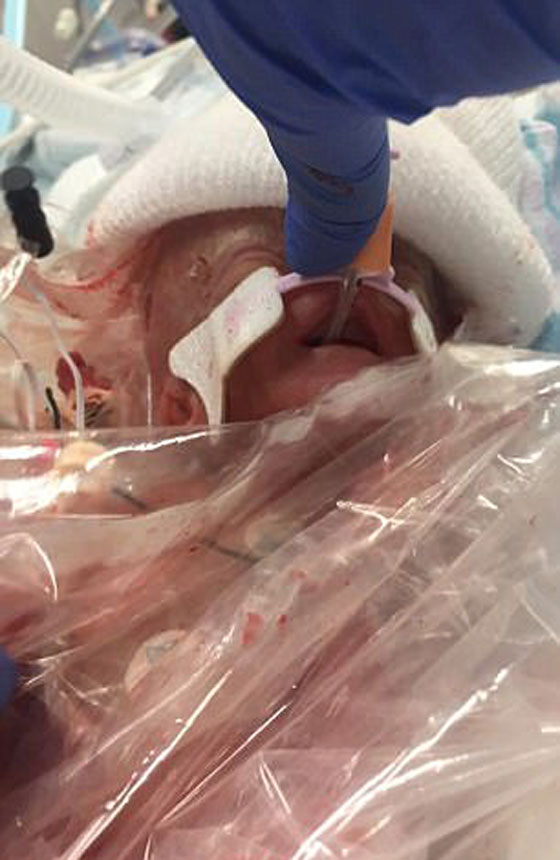 قصة مؤثرة للغاية.. امريكية اختارت ان تموت لكي يعيش جنينها صورة رقم 5