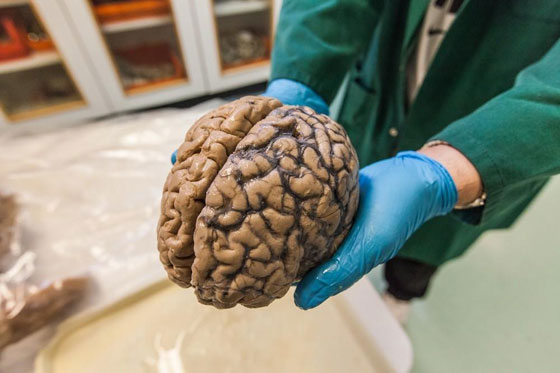 في هذه الدول اعضاؤك ليست ملكك بعد الوفاة.. بين التبرع الالزامي ورفضه! صورة رقم 5