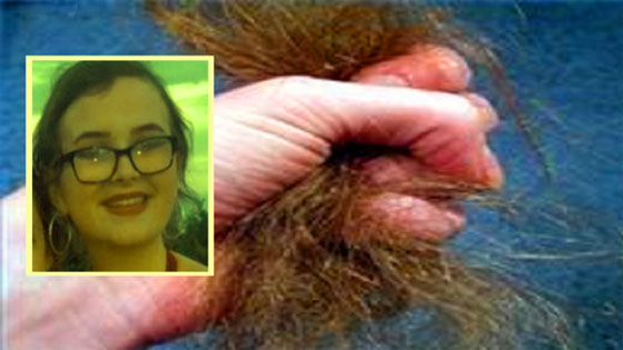 ياسمين نتفت شعرها واكلته حتى تعطل جهازها الهضمي وفارقت الحياة! صورة رقم 1