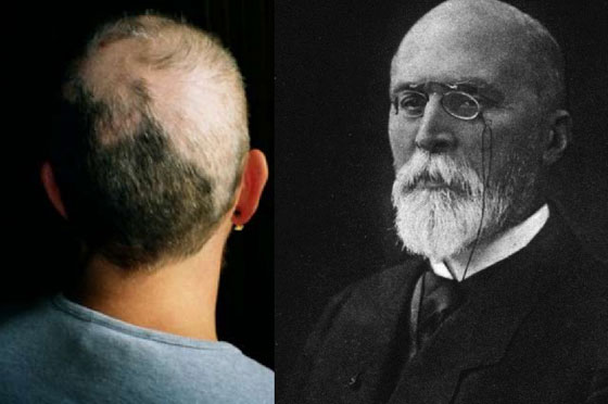 ياسمين نتفت شعرها واكلته حتى تعطل جهازها الهضمي وفارقت الحياة! صورة رقم 4